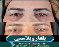 عمل پلک