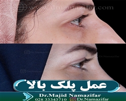 عمل پلک