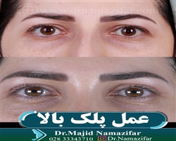 عمل پلک