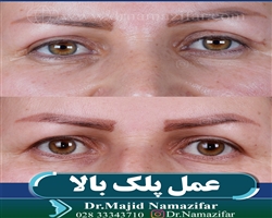 عمل پلک