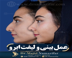 لیفت ابرو