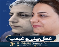 غبغب
