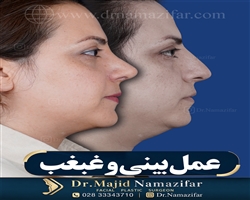 غبغب